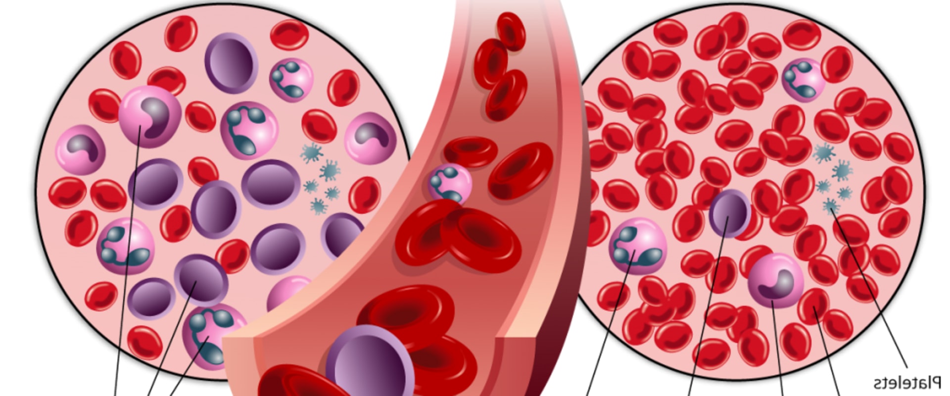 Understanding Leukemia in Children: Insights and Advances