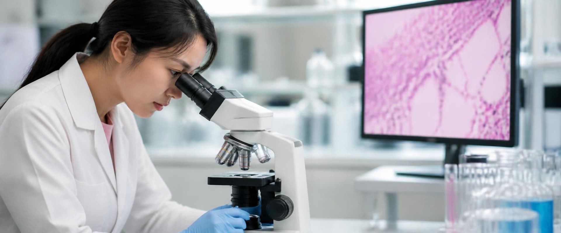 Understanding Breast Cancer: Latest Research and Advancements