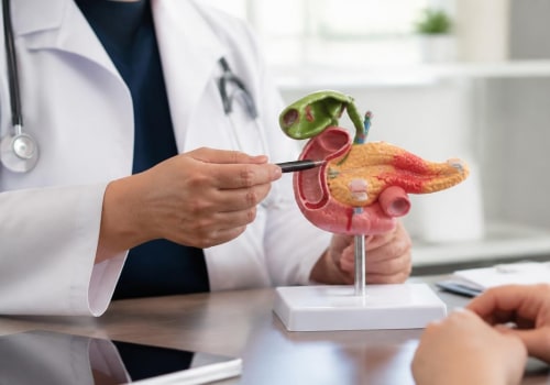 Understanding Pancreatic Cancer: Latest Advances and Insights