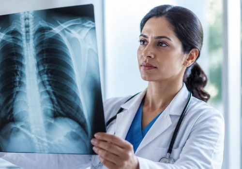 Understanding Lung Cancer: Recent Advances and Insights